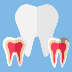 Como Prevenir Caries