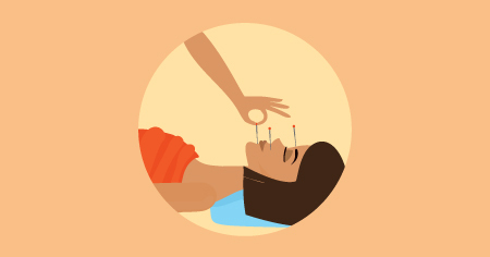 acupuntura para dor de cabeça