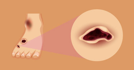 Curso online de podologia