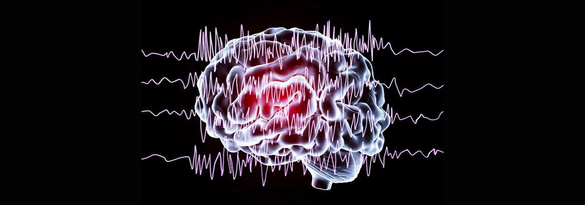 Crise Convulsiva - Noções